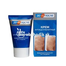 Cream against cellulite and improvement of blood circulation in cells - "Before and After" 100 ml